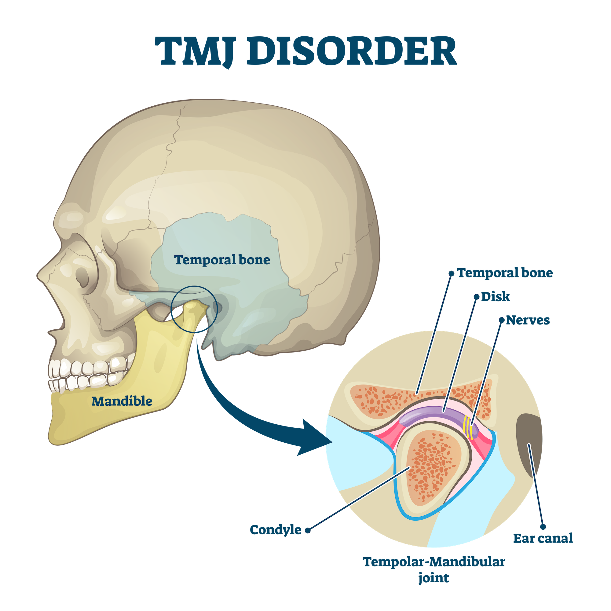 Featured image for “How Do I Know If I Have TMJ?”
